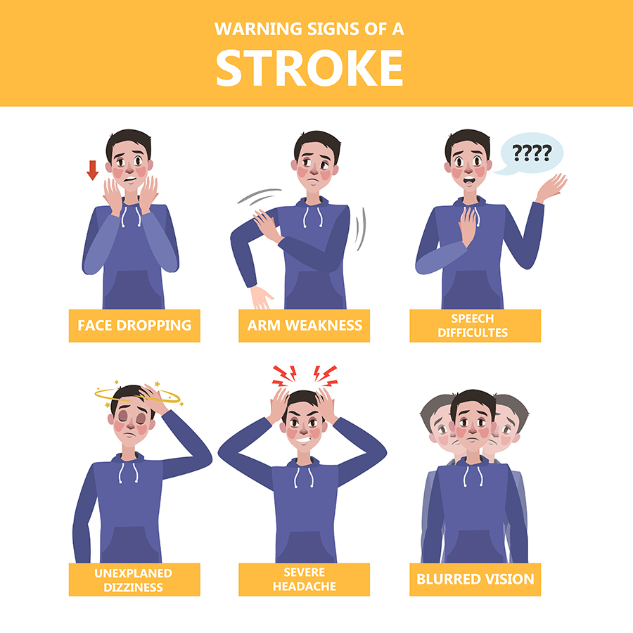 signs of a stroke